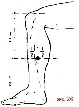 ris-26