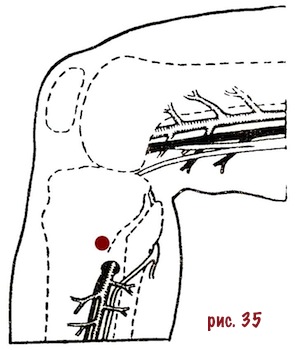 ris-35-dsu-san-li